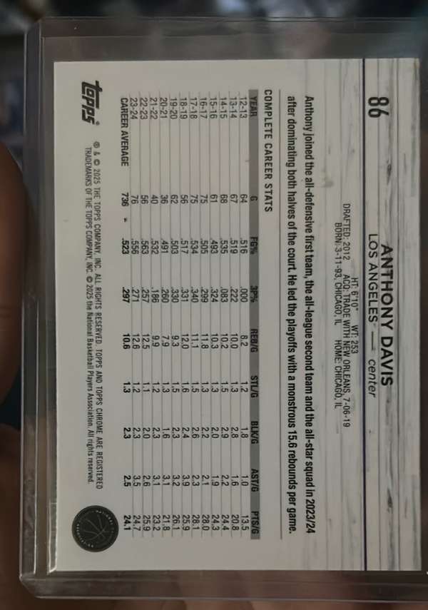 Card back
